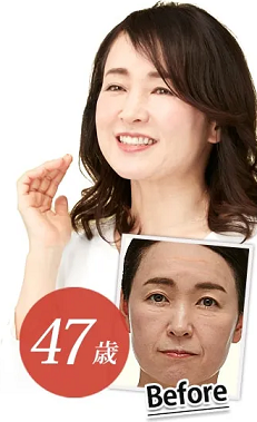 リフトマキシマイザーを使用したよろこびの声3
アフリエイト広告を利用してます。