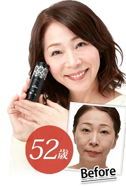 リフトマキシマイザーを
使用したよろこびの声1
アフリエイト広告を利用してます。