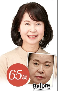 リフトマキシマイザーを使用したよろこびの声2
アフリエイト広告を利用してます。